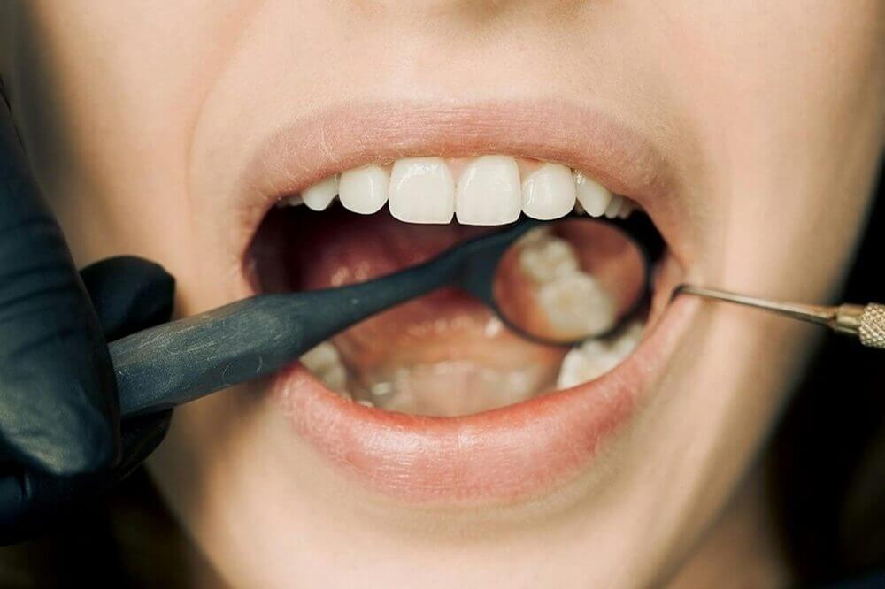 Jak poradzić sobie z bólem zęba z dziurą