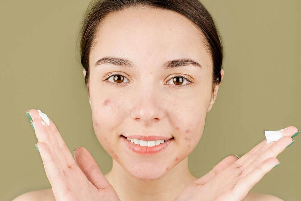 Skuteczny antybiotyk na trądzik rodzaje, wskazania