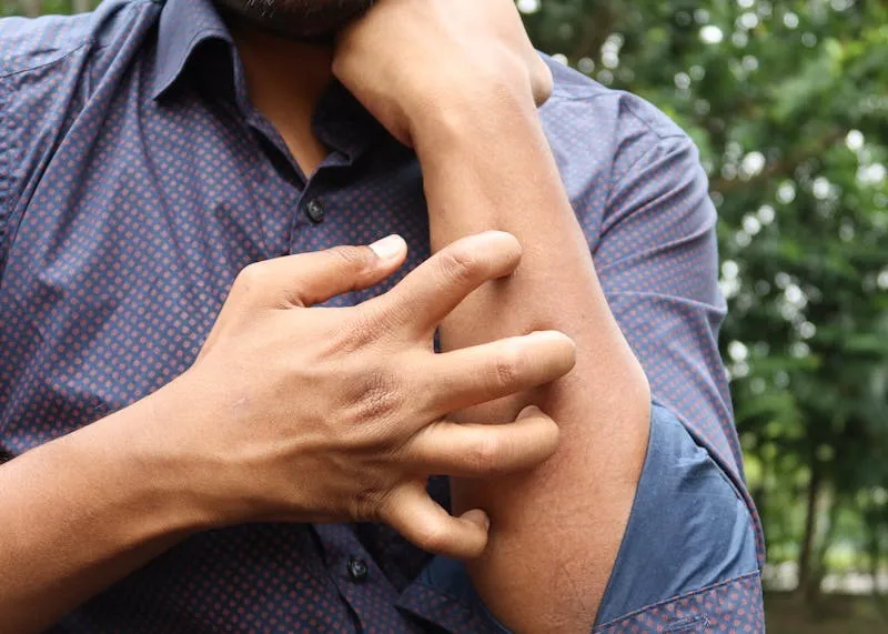 Maści i leki na świerzb – co stosuje się w leczeniu świerzbu dzieci i dorosłych?